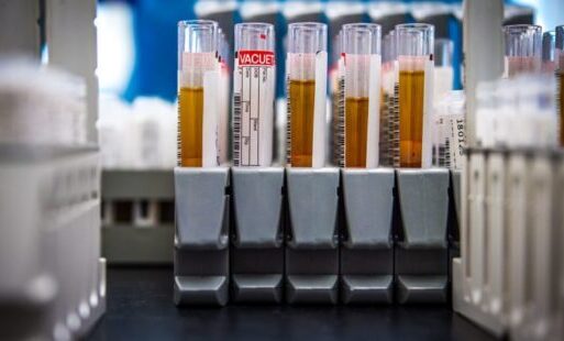 Zdjęcie do Koronawirus &ndash; będą trzy nowe laboratoria na Pomorzu
